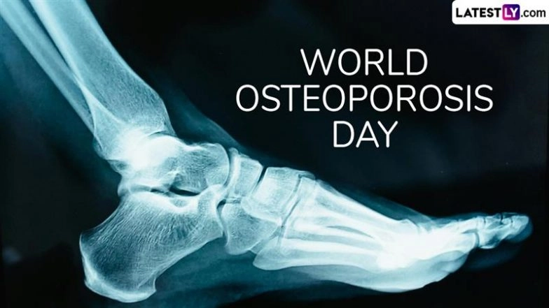 World Osteoporosis Day 2025: Date, Theme, History and Significance for Bone Health Awareness
