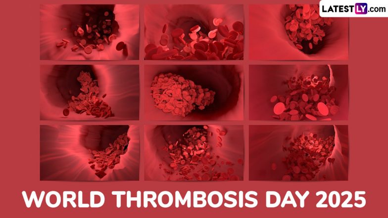 World Thrombosis Day 2025: Date, Theme, History and Key Facts About Thrombosis - Causes, Types, Risk Factors, Symptoms and Prevention Tips