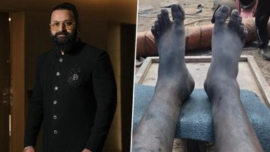 Rishab Shetty Reveals He Shot ‘Kantara: Chapter 1’ Climax With ‘A Swollen Leg and Exhausted Body’