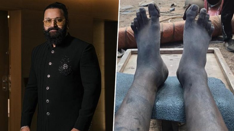 Rishab Shetty Reveals He Shot ‘Kantara: Chapter 1’ Climax With ‘A Swollen Leg and Exhausted Body’