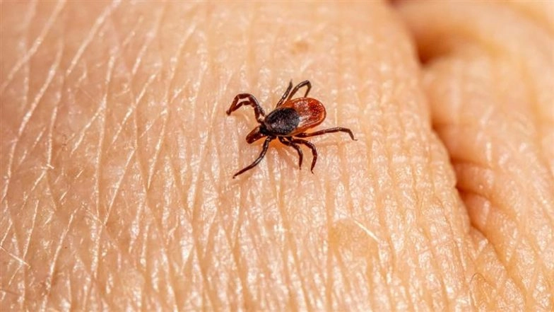 What Is Alpha-Gal Syndrome? All About Tick-Borne Red Meat Allergy That Caused Pilot’s Death in New Jersey