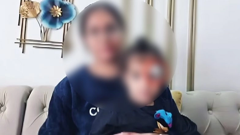 Meerut Shocker: Doctor Allegedly Uses Fevikwik Instead of Stitches To Seal Wound Near Toddler’s Eye at Private Hospital in UP; Investigation Underway