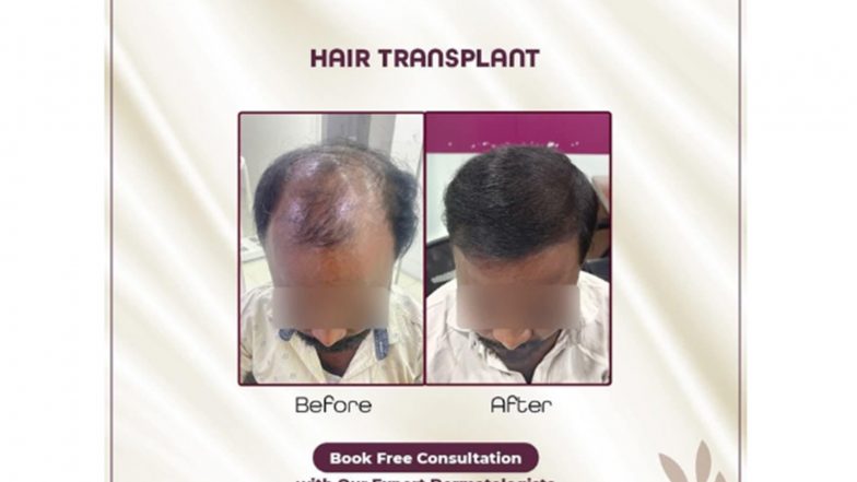 Business News | Rapid Nationwide Expansion: Layers Skin and Hair Clinics Continues to Sculpt Beauty Inside and Out