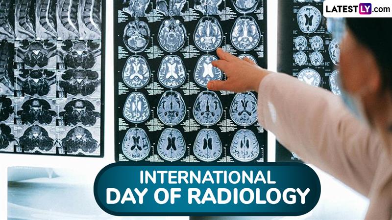 International Day of Radiology 2025: Date, Theme, History and Why Radiology Matters in Modern Healthcare