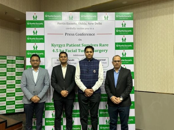 India News | Delhi: 4.5 Kg Facial Tumour Successfully Removed from Kyrgyz Patient