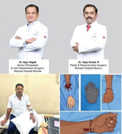 Business News | Manipal Hospitals' Mysuru Team Successfully Performs Life-Saving Hand Replantation
