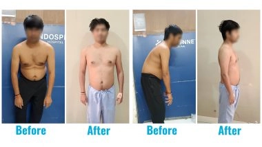 Business News | A 31-year-old Who Lived on a Chair... Until His Spine Finally Said, 'Enough'