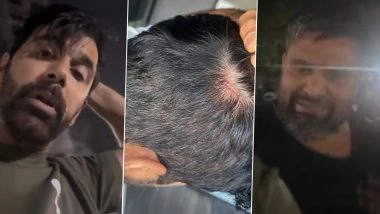 TV Actor Anuj Sachdeva Brutally Attacked Over Parking Dispute, FIR Filed