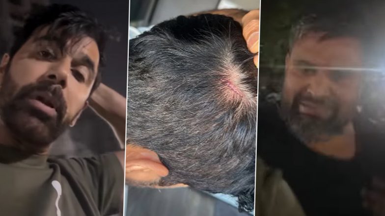 Anuj Sachdeva Assaulted by Neighbour After Parking Row in Mumbai Society, ‘Saath Nibhaana Saathiya’ Actor Files Police Complaint