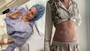 Lili Reinhart Reveals Endometriosis Diagnosis After Years of Pain and Misdiagnosis, Says 'Glad I Trusted My Body and Listened to My Gut' (View Pics)