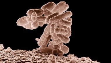 What Is E. Coli Infection? Know Symptoms, Causes and Preventive Tips