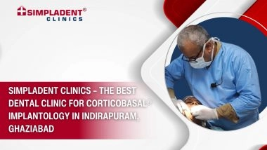 Business News | Simpladent Clinics - The Best Dental Clinic for Corticobasal® Implantology in Indirapuram, Ghaziabad