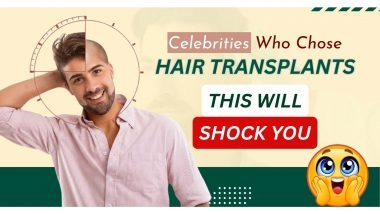 Business News | Celebrity Hair Transplant: You'd Never Guess They Had a Hair Transplant- But They Did