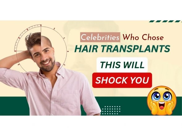 Business News | Celebrity Hair Transplant: You'd Never Guess They Had a Hair Transplant- But They Did