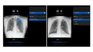 Business News | Manipal Hospitals Adopts Harrison.ai's Chest X-ray AI to Improve Patient Outcomes