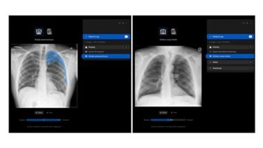 Business News | Manipal Hospitals Adopts Harrison.ai's Chest X-ray AI to Improve Patient Outcomes