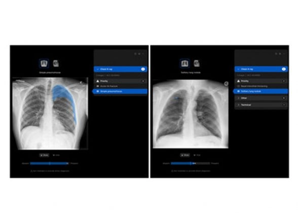 Business News | Manipal Hospitals Adopts Harrison.ai's Chest X-ray AI to Improve Patient Outcomes
