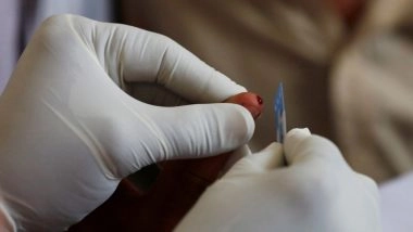 World News | Pakistan: National Assembly Meeting Reports Whopping 3,00,000 Cases of HIV; Only 34,000 Patients Under Treatment