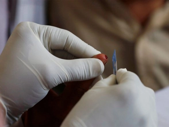 World News | Pakistan: National Assembly Meeting Reports Whopping 3,00,000 Cases of HIV; Only 34,000 Patients Under Treatment