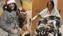 Dog Lick Turns Deadly: UK Woman Loses All 4 Limbs After Severe Sepsis, All You Need To Know About Life-Threatening Condition