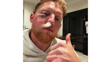 Sports News | England Test Captain Ben Stokes Suffers Facial Injury