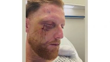 Sports News | England Test Captain Ben Stokes Undergoes Successful Facial Surgery