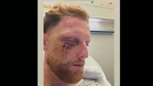 sports-Ben Stokes Undergoes Surgery After Facial Injuries Following Training Accident, Vows to Wear Helmet Always