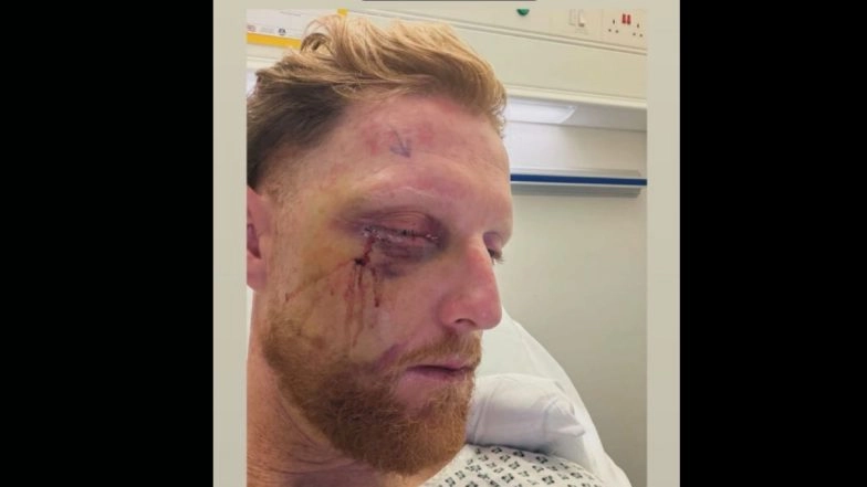 Ben Stokes Undergoes Surgery After Facial Injuries Following Training Accident, Vows to Wear Helmet Always