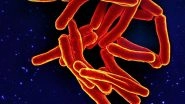 What Is Tuberculosis? US Sees Rise in TB Cases; Check Symptoms and Risks What Is Tuberculosis? US Sees Rise in TB Cases; Check Symptoms and Risks