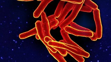 What Is Tuberculosis? US Sees Rise in TB Cases; Check Symptoms and Risks