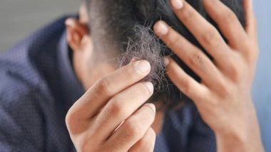 Business News | What Are the Main Causes of Hair Fall in Men?