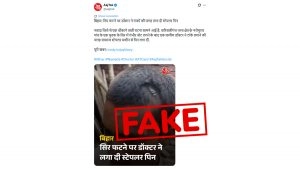 social-viral-Did Bihar Doctor Really Use Normal Stapler Pins to Stitch Head Wounds? Aaj Tak Mistakes Medical Stapler for Stationery One