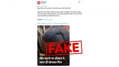 Did Bihar Doctor Really Use Normal Stapler Pins to Stitch Head Wounds? Aaj Tak Mistakes Medical Stapler for Stationery One