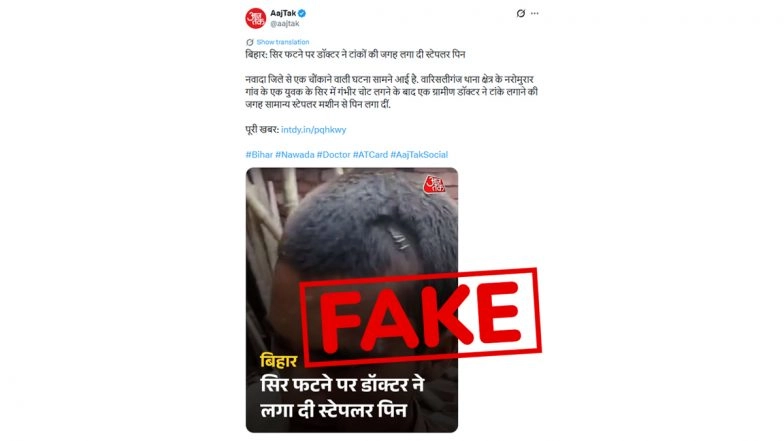 Did Bihar Doctor Really Use Normal Stapler Pins to Stitch Head Wounds? Aaj Tak Mistakes Medical Stapler for Stationery One