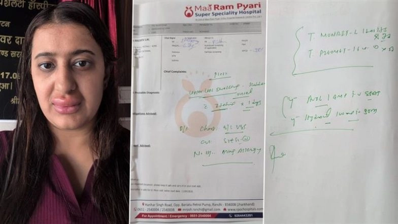 Vande Bharat Express Food Scare? Woman Claims Severe Allergy, Child Falls Ill After Train Meal (See Pics)
