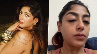 ‘Splitsvilla 16’ Fame Preet Singh Shares Traumatic Assault Incident at Mumbai Club, Says ‘Eyes Swollen, Face Bruised’ (Watch Video)