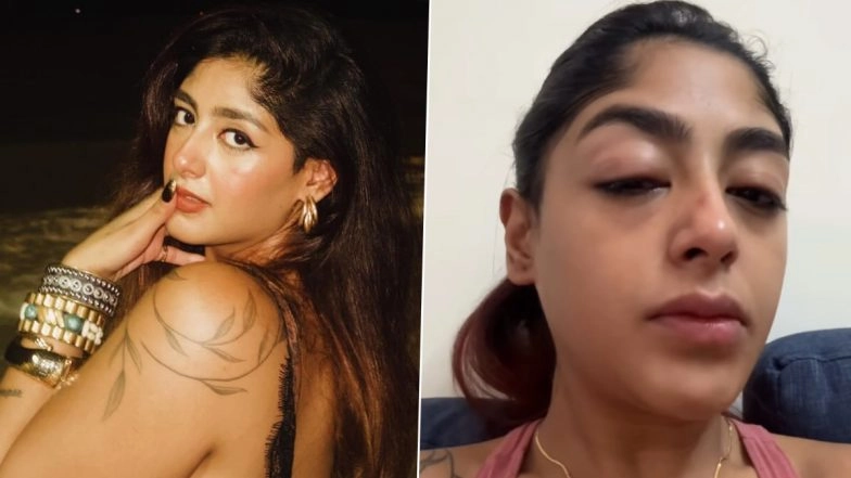 &lsquo;Splitsvilla 16&rsquo; Fame Preet Singh Shares Traumatic Assault Incident at Mumbai Club, Says &lsquo;Eyes Swollen, Face Bruised&rsquo; (Watch Video)