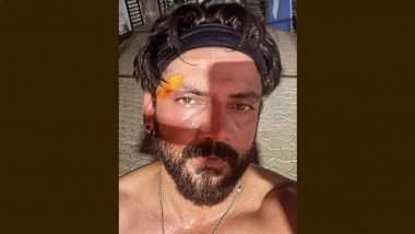 Zaheer Iqbal Head Injury: Sonakshi Sinha&rsquo;s Husband Shares Photo of First Padel Injury on Social Media (View Post)