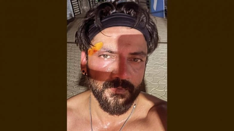 Zaheer Iqbal Injured During Padel Match