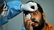 India News | Researchers Urge for Microbiology-guided Diagnosis Following Discovery of Drug-resistant Eye Pathogens