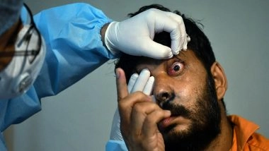 India News | Researchers Urge for Microbiology-guided Diagnosis Following Discovery of Drug-resistant Eye Pathogens