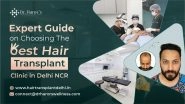 Business News | Expert Guide on Choosing the Best Hair Transplant Clinic in Delhi NCR