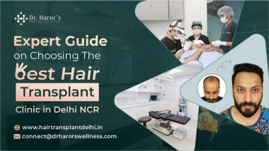 Business News | Expert Guide on Choosing the Best Hair Transplant Clinic in Delhi NCR