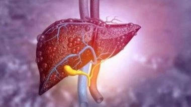 Delhi: 10-Year-Old Girl Suffers Liver Failure in Burari After Excessive Momos Consumption; Shows Memory Loss and Mobility Issues