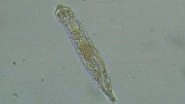 Microscopic &lsquo;Zombie Worm&rsquo; Revived: Scientists Revive Bdelloid Rotifer After 24,000 Years From Siberian Ice; Here&rsquo;s What Happened Next