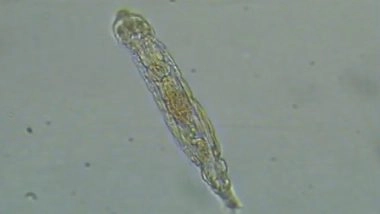 Microscopic ‘Zombie Worm’ Revived: Scientists Revive Bdelloid Rotifer After 24,000 Years From Siberian Ice; Here’s What Happened Next