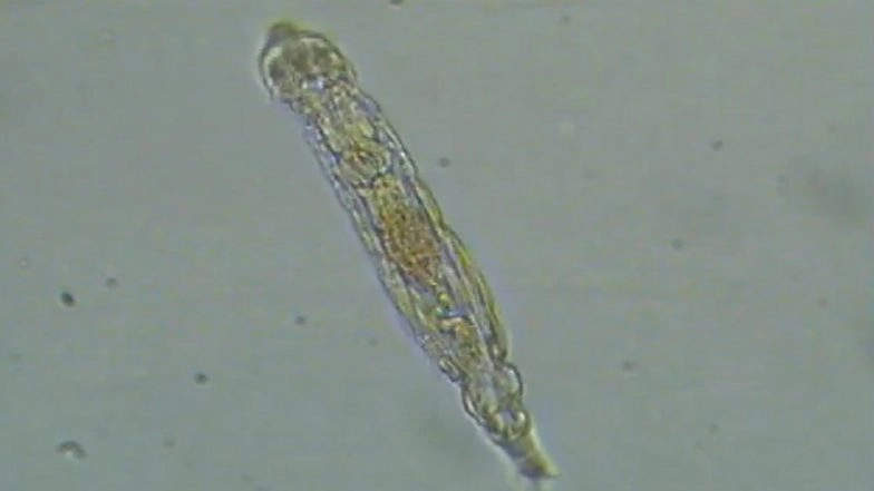 Microscopic &lsquo;Zombie Worm&rsquo; Revived: Scientists Revive Bdelloid Rotifer After 24,000 Years From Siberian Ice; Here&rsquo;s What Happened Next
