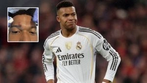Kylian Mbappe Highlights Forehead Injury Inflicted in Real Madrid vs Girona La Liga 2026 Match, Shares Pic on IG