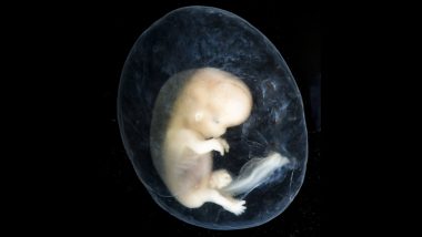 Israeli National Arrested at Cyprus Airport After 4 Embryos Found in &lsquo;Life Parcel&rsquo; Container