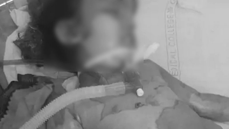 Gorakhpur Shocker: 3-Year-Old Girl Dies After Accidentally Falling Into Boiling Sugar Syrup During Wedding Ceremony in Uttar Pradesh